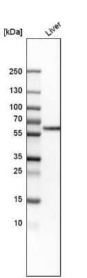 Western Blot: Monoamine Oxidase B Antibody [NBP1-87493]