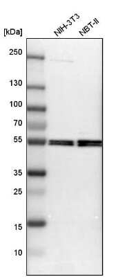 Western Blot: Monoamine Oxidase B Antibody [NBP1-87493]