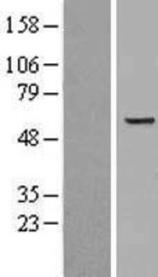 Western Blot: Monoamine Oxidase B Overexpression Lysate [NBL1-12842]