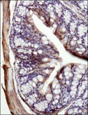 Immunohistochemistry-Paraffin: MCT1/SLC16A1 Antibody - BSA Free [NBP1-59656]