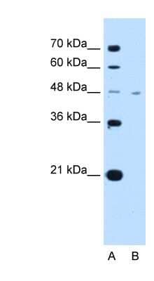 Western Blot: MCT1/SLC16A1 AntibodyBSA Free [NBP1-59656]