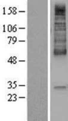 Western Blot: MCT1/SLC16A1 Overexpression Lysate [NBP2-11461]