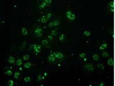 Immunocytochemistry/ Immunofluorescence: Monoglyceride Lipase Antibody (OTI2B11) [NBP2-00735]