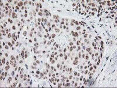 Immunohistochemistry-Paraffin: Monoglyceride Lipase Antibody (OTI2B11) [NBP2-00735]