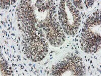 Immunohistochemistry-Paraffin: Monoglyceride Lipase Antibody (OTI2B11) [NBP2-00735]