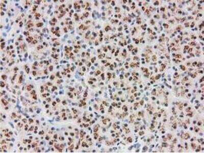 Immunohistochemistry-Paraffin: Monoglyceride Lipase Antibody (OTI2B11) [NBP2-00735]