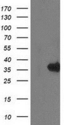 Western Blot: Monoglyceride Lipase Antibody (OTI2B11) [NBP2-00735]