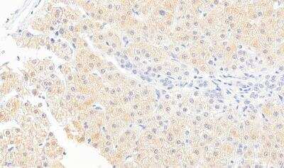 Immunohistochemistry-Paraffin: Monoglyceride Lipase Antibody [NB100-96920]