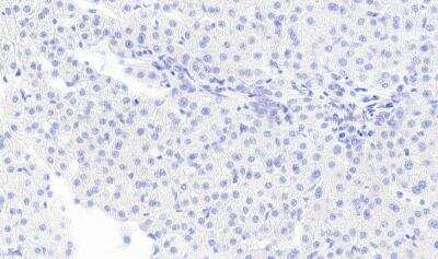 Immunohistochemistry-Paraffin: Monoglyceride Lipase Antibody [NB100-96920]