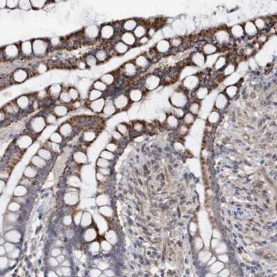 Immunohistochemistry-Paraffin: Monoglyceride Lipase Antibody [NBP1-89646]