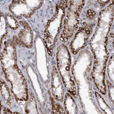 Immunohistochemistry-Paraffin: Monoglyceride Lipase Antibody [NBP1-89646]