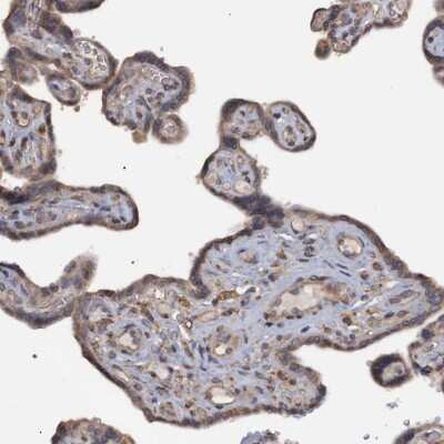 Immunohistochemistry-Paraffin: Monoglyceride Lipase Antibody [NBP1-89646]