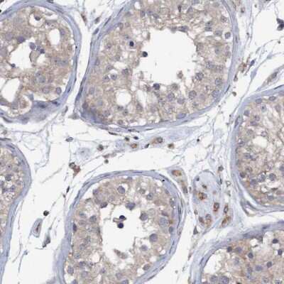 Immunohistochemistry-Paraffin: Monoglyceride Lipase Antibody [NBP1-89646]