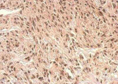 Immunohistochemistry-Paraffin: Monoglyceride Lipase Antibody [NBP2-19380]