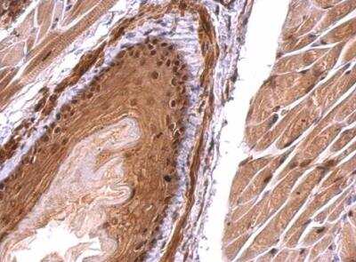 Immunohistochemistry-Paraffin: Monoglyceride Lipase Antibody [NBP2-19380]