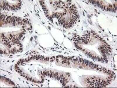 Immunohistochemistry: Monoglyceride Lipase Antibody (OTI2B11) - Azide and BSA Free [NBP2-72759]