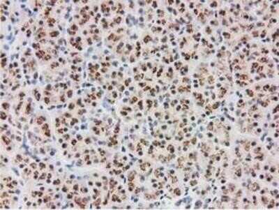 Immunohistochemistry: Monoglyceride Lipase Antibody (OTI2B11) - Azide and BSA Free [NBP2-72759]