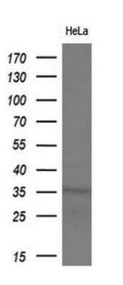 Western Blot: Monoglyceride Lipase Antibody (OTI2B11)Azide and BSA Free [NBP2-72759]