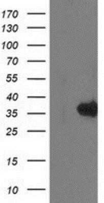 Western Blot: Monoglyceride Lipase Antibody (OTI2B11)Azide and BSA Free [NBP2-72759]