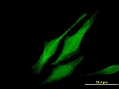 Immunocytochemistry/ Immunofluorescence: Morg1 Antibody (4E12) [H00084292-M02]