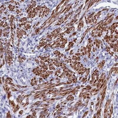 Immunohistochemistry-Paraffin: Morg1 Antibody [NBP1-92132]