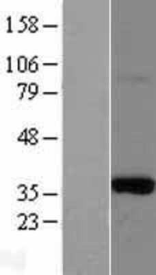 Western Blot: Morg1 Overexpression Lysate [NBP2-11426]