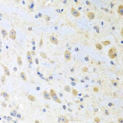 Immunohistochemistry-Paraffin: Motilin Antibody - BSA Free [NBP2-93868]