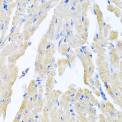 Immunohistochemistry-Paraffin: Motilin Antibody - BSA Free [NBP2-93868]