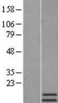 Western Blot: Motilin Overexpression Lysate [NBP2-10829]