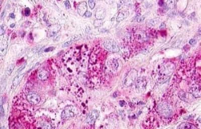 Immunohistochemistry: Motilin R/GPR38 Antibody [NBP3-14407]