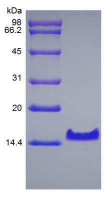 SDS-PAGE: Recombinant Mouse Betacellulin/BTC Protein [NBP2-35148]