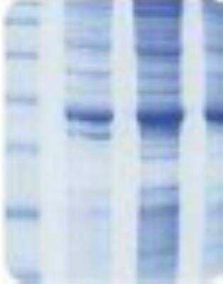 SDS-PAGE: Mouse Brain Whole Tissue Lysate (Adult Whole Normal) [NB820-59657]