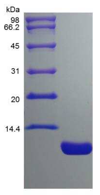 SDS-PAGE: Recombinant Mouse CCL17/TARC Protein [NBP2-35183]