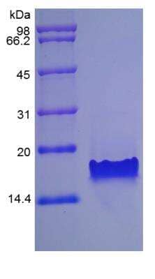 SDS-PAGE: Recombinant Mouse CCL25/TECK Protein [NBP2-35184]