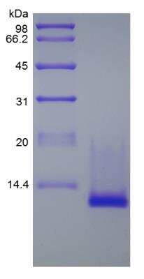 SDS-PAGE: Recombinant Mouse CCL27/CTACK Protein [NBP2-35164]