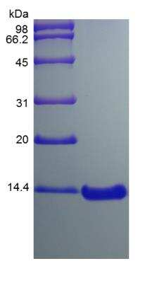 SDS-PAGE: Recombinant Mouse CCL7/MCP-3/MARC Protein [NBP2-35161]