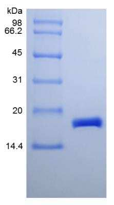 SDS-PAGE: Recombinant Mouse CDNF Protein [NBP2-35162]