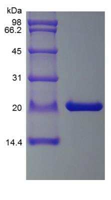 SDS-PAGE: Recombinant Mouse CNTF Protein [NBP2-35168]