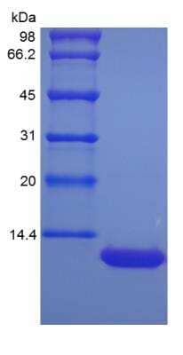 SDS-PAGE: Recombinant Mouse CXCL5/ENA-78 Protein [NBP2-35157]