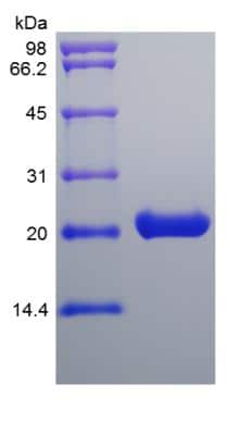 SDS-PAGE: Recombinant Mouse Cardiotrophin-1/CT-1 Protein [NBP2-35170]