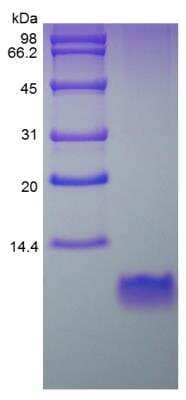 SDS-PAGE: Recombinant Mouse Defensin beta 2 Protein [NBP2-35144]