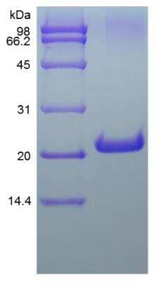 SDS-PAGE: Recombinant Mouse FGF-21 Protein [NBP2-35031]