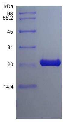 SDS-PAGE: Recombinant Mouse FGF-9 Protein [NBP2-35036]