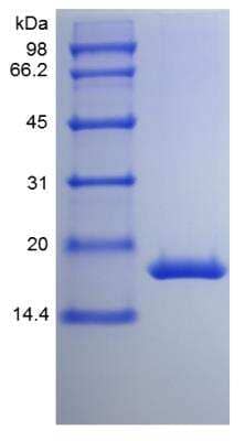 SDS-PAGE: Recombinant Mouse G-CSF Protein [NBP2-35061]