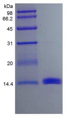 SDS-PAGE: Recombinant Mouse GM-CSF Protein [NBP2-35066]