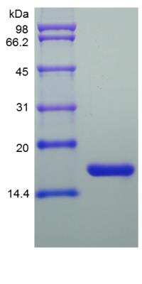 SDS-PAGE: Recombinant Mouse IL-1ra/IL-1F3/IL1RN Protein [NBP2-35105]