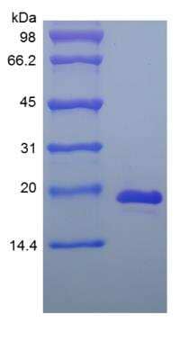 SDS-PAGE: Recombinant Mouse IL-33 Protein [NBP2-35124]