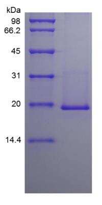 SDS-PAGE: Recombinant Mouse IL-36 beta/IL-1F8 Protein [NBP2-35130]