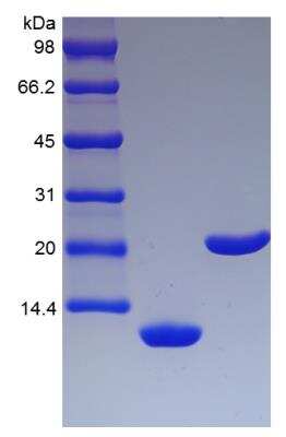 SDS-PAGE: Recombinant Mouse IL-5 Protein [NBP2-35132]