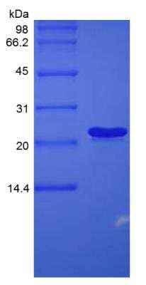 SDS-PAGE: Recombinant Mouse IL-6 Protein [NBP2-35134]